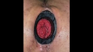 Dilatador anal rosebud