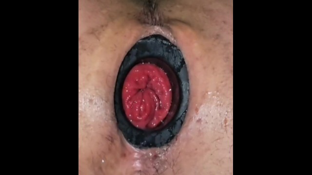 Dilatador anal rosebud