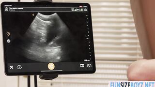 Time for my medical anal sex with hot doctor