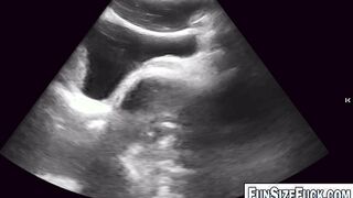 Something Was MOVING Inside His Belly!
