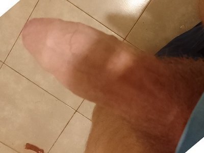 mi prepucio en primer plano